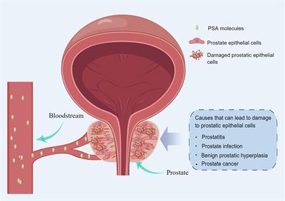 Frontiers | Application And Optimization Of Prostate-specific Antigen ...